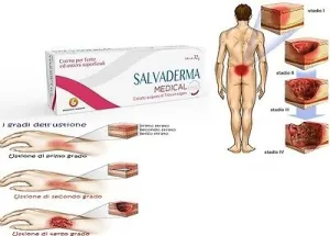 Salvaderma Medical crema pentru cicatrizare